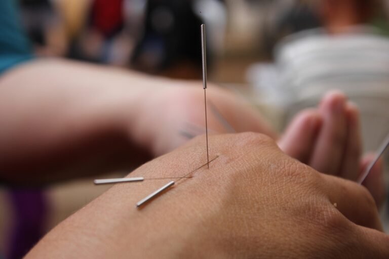 L’acupuncture, une alternative naturelle et efficace contre la douleur chronique